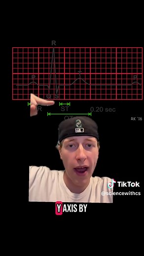 Understanding Your ECG: P-QRS-T Waves Explained