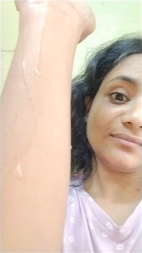 Medwiser+ on Instagram: "Hyperhidrosis- : excessive sweating over hands (palmar hyperhidrosis), feet (plantar hyperhidrosis), axilla (axillary hyperhidrosis), Facial or cranial sweating.... #condition#medicine#medicalcollege#mbbs#instareel#palms#study#classes#instagram#reeledit"