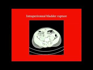 Distal Genitourinary Trauma - CRASH! Medical Review Series