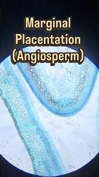 What Microorganisms Really Look Like Under a Microscope 🔬 (Students’ Epic Reactions!)” #science