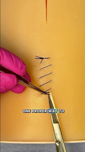 Running Stitch Removal – Clinical Pearl ✨ #clinicalskills #medicaleducation #howtostitch #stitches