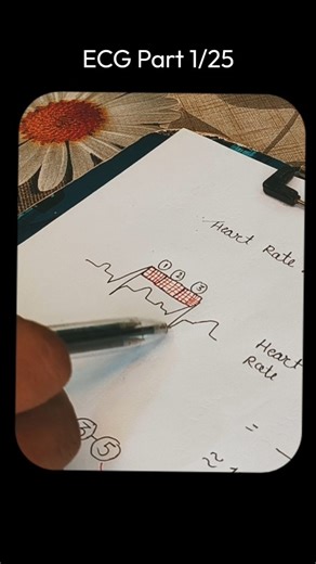 Dr Tejas Admane on Instagram: "ECG Part 01/25 ECG looks confusing? NOT anymore! 📈❤️ If you understand THIS, you understand ECG! From P wave to T wave – every line tells a story. Save this reel before your next exam / emergency duty!” ECG interpretation, P wave QRS complex T wave, arrhythmia, MI ECG, emergency ECG, medical reels, cardiology basics DOCTOR BAMS MBBS BHMS"