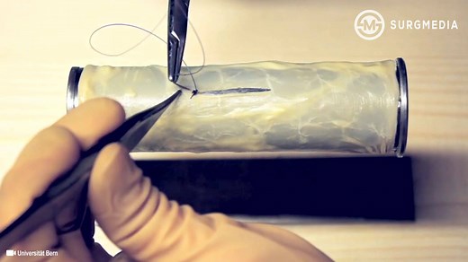 Cushing Suture Pattern: Fast, Continuous, Easy Inverting Suture Technique for Intestinal Incision