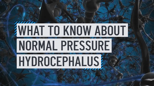 What to know about normal pressure hydrocephalus