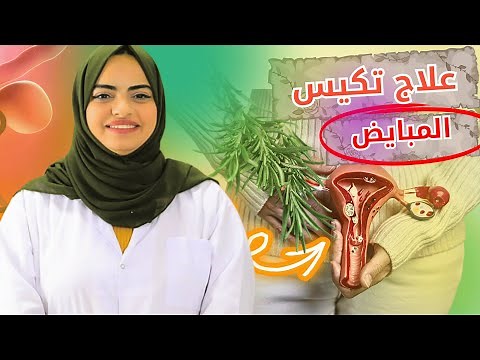 علاج تكيس المبايض بالأعشاب طرق فعالة ومضمونة 100%