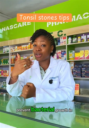 How to Manage Tonsil Stones and Prevent Mouth Odour