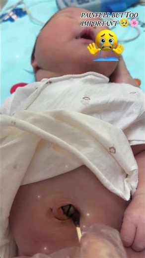 POV: Your First Time Cleaning Baby’s Belly Button 👶🥺 #Shorts