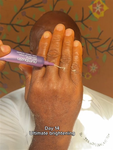 Knuckles Numbuzin RetiNAD Challenge: Retinal NAD Explained