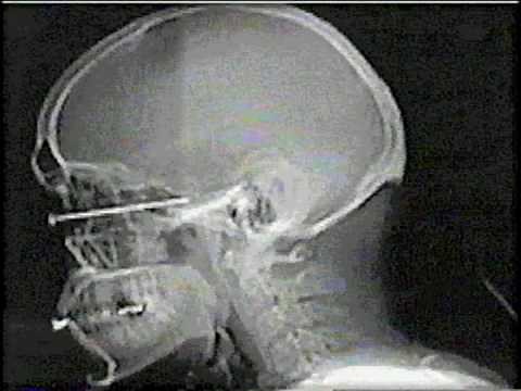 Protecting Your Eyesight