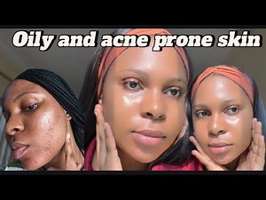 Step by step routine for oily and acne prone skin: how I cleared my acne