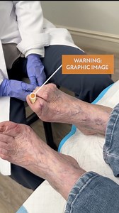 3.7K views · 17 reactions | Fungal infections: they're not so 'fun'...