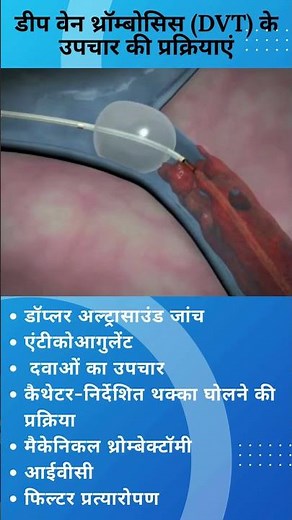 DVT (Deep Vein Thrombosis): Don't Ignore Leg Swelling & Pain | Dr Amey