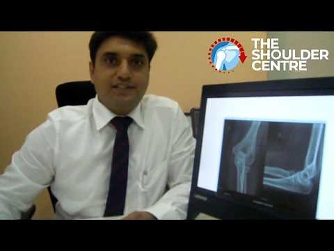 How to Send a Picture of Your X-Ray to A Doctor? - Dr. Harshad Jawalkar