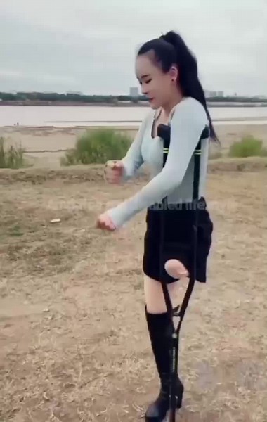 Chinese LAK amputee lady - super sexy on one crutch.
