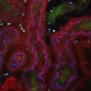 File:Uropathogenic-Escherichia-coli-P-and-Type-1-Fimbriae-Act-in-Synergy-in-a-Living-Host-to-Facilitate-ppat.1001298.s004.ogv - Wikimedia Commons