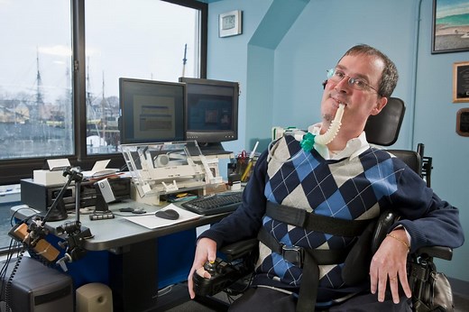 Science is rewriting the Duchenne muscular dystrophy lifespan. Care must catch up - Monash Lens