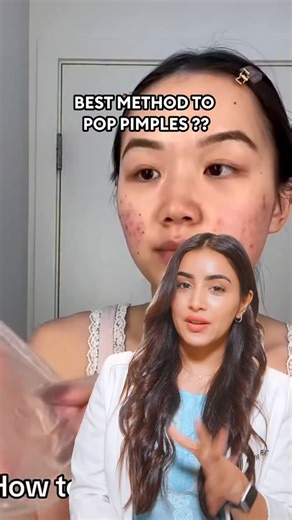 Dr. Riya Thorat | 🚨 Occasional acne? Normal. But stop doing this: ❌ Toothpaste ❌ DIY hacks ❌ Popping & squeezing These only cause inflammation, pigmentation... | Instagram