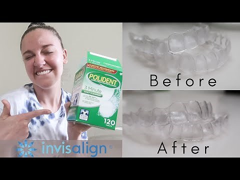 INVISALIGN UPDATE: Tips and Tricks for Clean Trays, No Stains or Smelly Trays!! + DEMO!