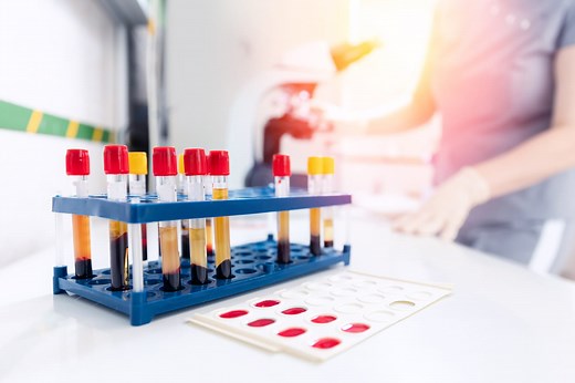 Globules rouges (hématies) : taux élevé, trop bas, causes ?