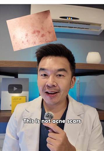 Post-Inflammatory Hyperpigmentation: Effective Solutions