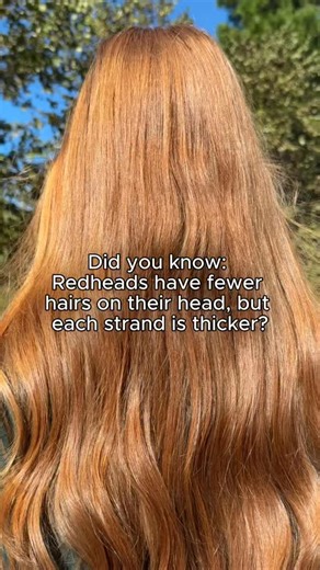 Nature’s way of giving redheads extra style in every strand. 👩‍🦰👨‍🦰 | How To Be A Redhead