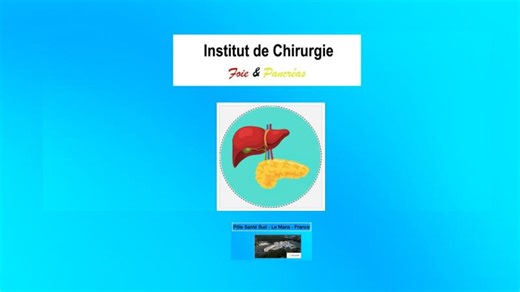 Robotic Mobilisation of the Uncinate process from left-to-right during pancreaticoduodenectomy | Edoardo Rosso