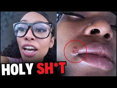 She Went To Houston For Spring Break… 42,000 Tested Positive for STDs