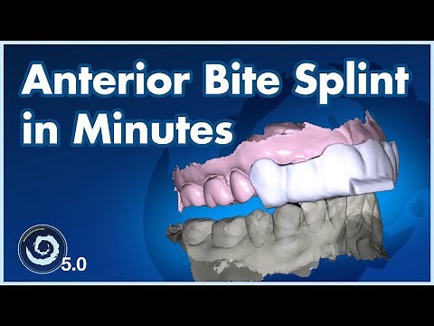 BSPV5.0 Design an Anterior Bite Splint in Minutes — Full Digital Workflow