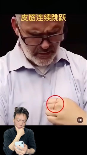 The rubber band moves on the finger. #magic