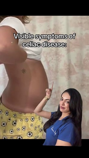 Understanding Celiac Disease Symptoms and Treatments
