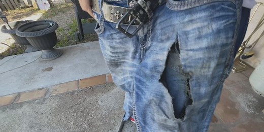 ‘It’s excruciating:’ Phoenix man shares warning after vape explosion