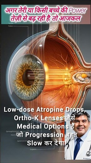 5 Proven Myopia Reduction Tips to Stop Your Eye Power from Increasing #myopia