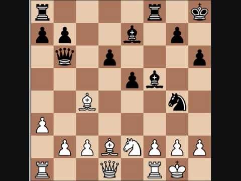 Chess Game Play- Game 1