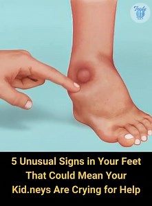 71K views · 21 reactions | ⚠️ “Your Feet Could Be Warning You About a Hidden Kidney Problem 5 Signs to Watch NOW” | Knorr | Facebook