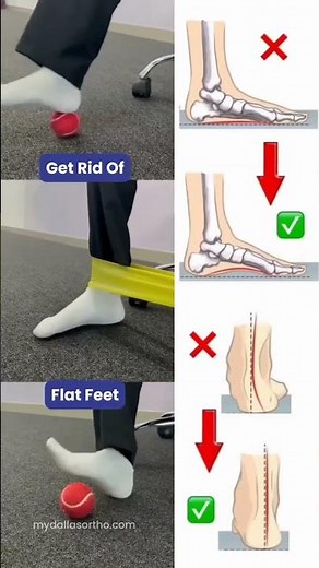 Flat Foot Exercises That Fix Arch Pain Fast (No Equipment!) #bodydecoded