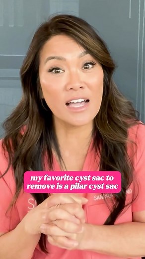 Sandra Lee, MD, FAAD, FAACS on Instagram: "Pilar cyst stans please rise 🙋🏻‍♀️🙋🏻‍♀️🙋🏻‍♀️🙋🏻‍♀️⁠ ⁠ If you need a Pilar cyst playlist to binge, click the link in my bio 😉⁠ ⁠ #drpimplepopper #popaholic"