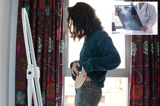 Colon cancer patients are 24 times more likely to die within 5 years if they had this habit before their diagnosis