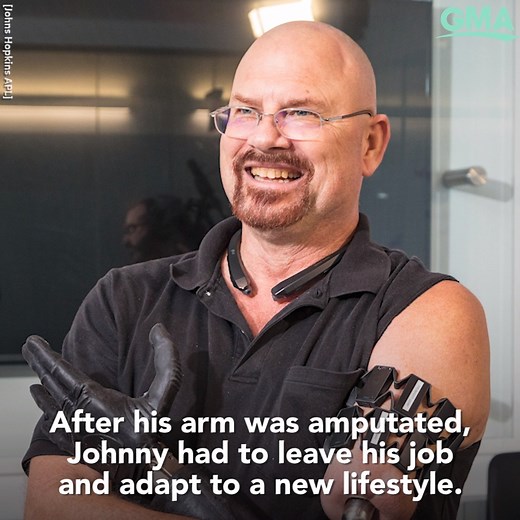 54K views · 88 reactions | Johnny Matheny has lived as an amputee since 2008 and has worked with Johns Hopkins APL to advance prosthetics’ functionality. https://gma.abc/30ADW8o | Good Morning America | Facebook