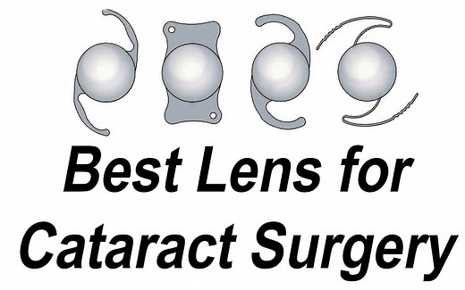 白内障手术的人工晶状体 (IOL)