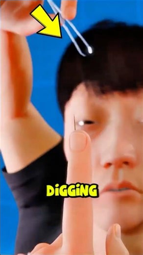 Never Pull Out a Splinter — Do This Instead 😳🩹 #shorts