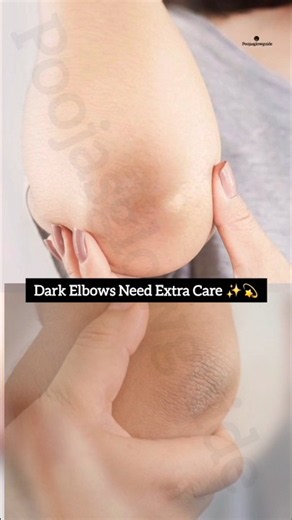 Dark Elbows? Try This Scrub for Rough Elbows & Smoother Skin ✨