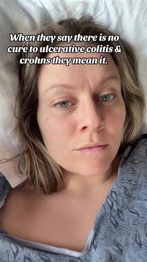 Understanding J Pouch Challenges After Ulcerative Colitis