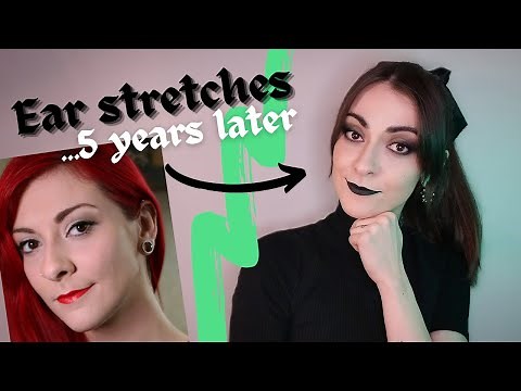 Will your stretched ears close up? Result after 5 years removal! (14 mm)