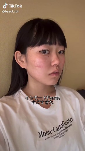 一生ついていくよフォーマちゃん🤝🏻 #韓国美容#韓国美容外科#韓国美容クリニック#韓国カフェ#韓国料理#韓国コスメ#韓国メイク#韓国ファッション#韓国ヘア#韓国語#韓国情報#江南#聖水#東大門#明洞#asmr#オリーブヤング#インモード #韓国#韓国旅行