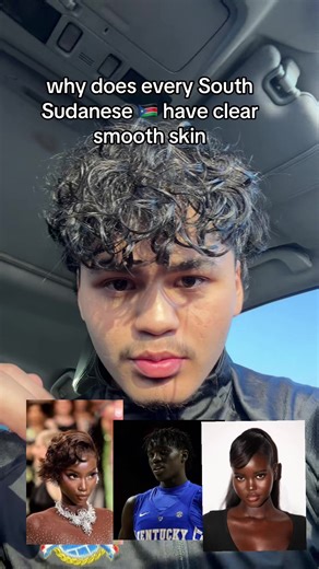 The Secret Behind South Sudanese Clear Skin