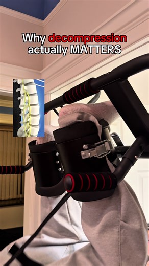 Someone lived with L4–L5–S1 disc-related back pain for 8 years. They laughed when I said reducing pressure could help. Because most people are told one thing: “Disc pain is permanent. Learn to live with it.” 🧠 What actually matters Spinal discs don’t have a direct blood supply. They stay healthy through pressure changes, not rest alone. When discs stay compressed for years—from sitting, posture, poor movement, or lack of load variation—fluid exchange slows, pressure builds, and nearby nerves st