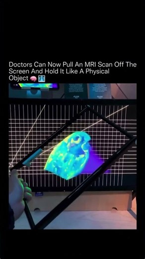 Is this the FUTURE of medicine???🤯