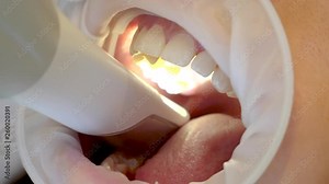 Close view of a dentist looking inside a mouth with a light