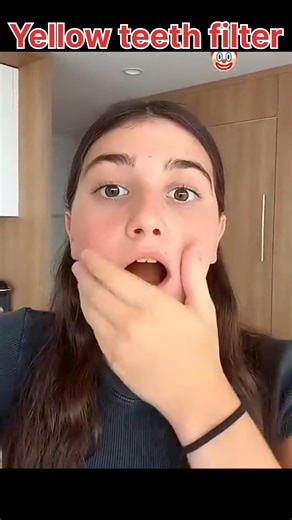 yellow teeth test #shorts