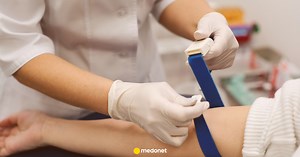 Nadmiar mocznika we krwi - objawy. Co oznacza podwyższony poziom mocznika?